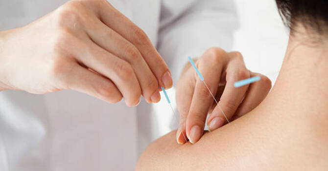 Unlocking the Wisdom of Traditional Chinese Medicine image